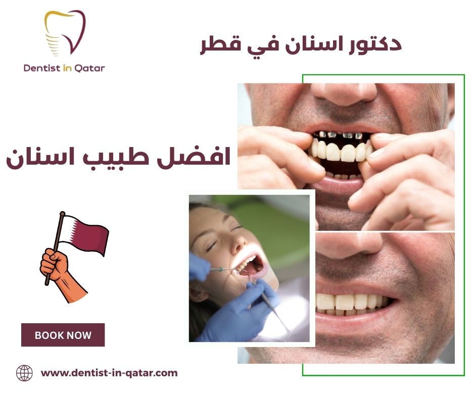 أفضل طبيب أسنان قطر