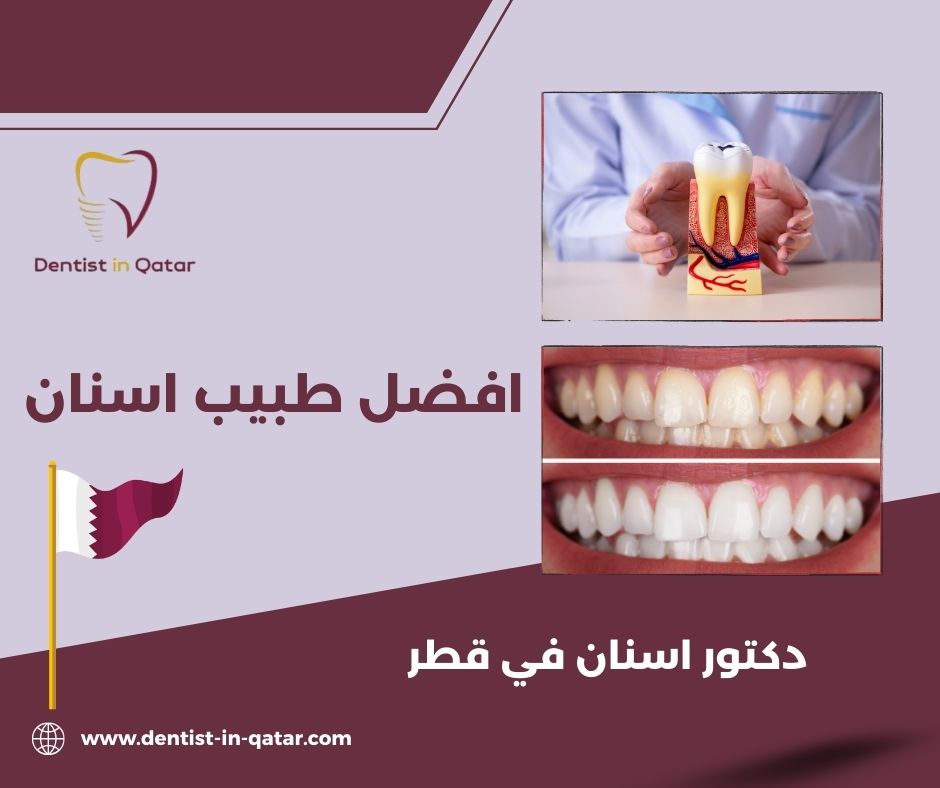 أفضل طبيب أسنان الدوحة