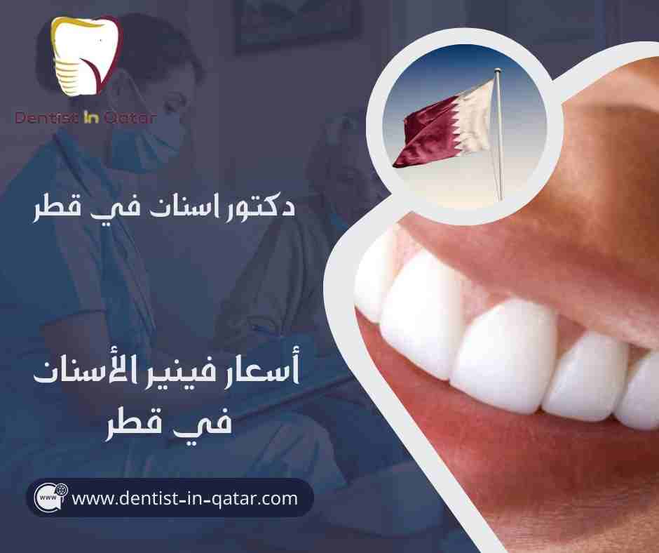 أسعار فينير الأسنان في قطر