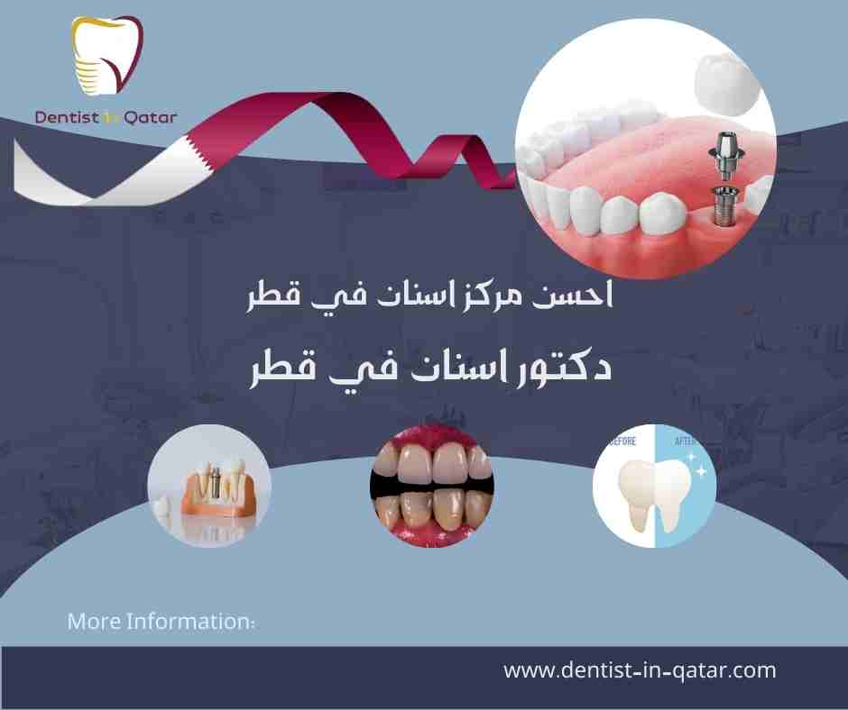احسن مركز اسنان في قطر