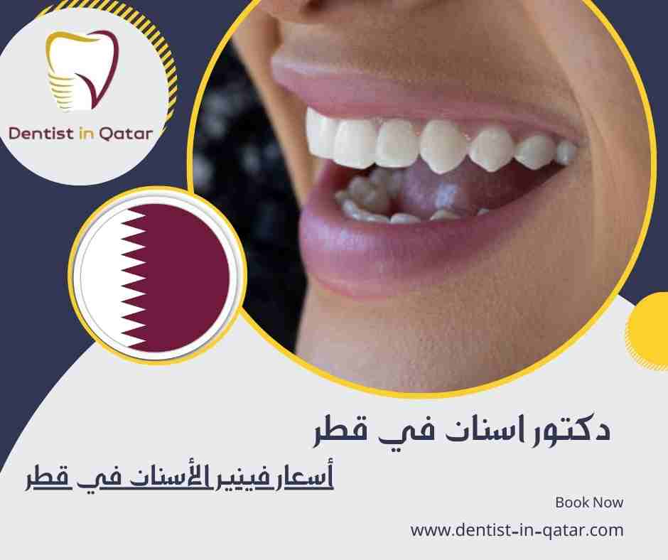 أسعار فينير الأسنان في قطر