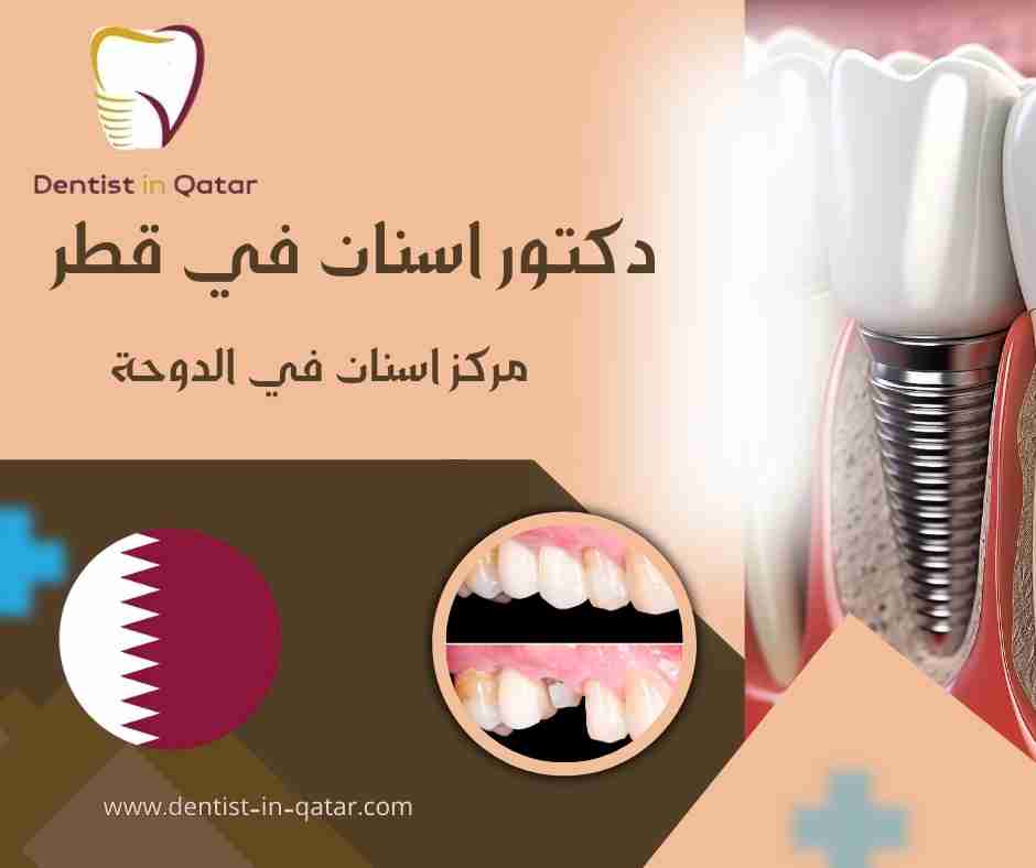 مركز اسنان في الدوحة