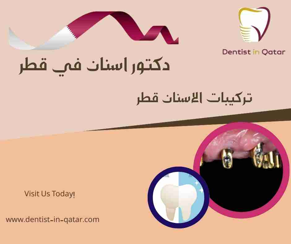 تركيبات الاسنان قطر