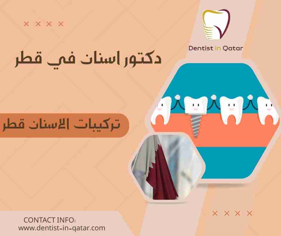 تركيبات الاسنان قطر