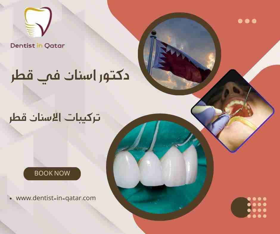 تركيبات الاسنان قطر