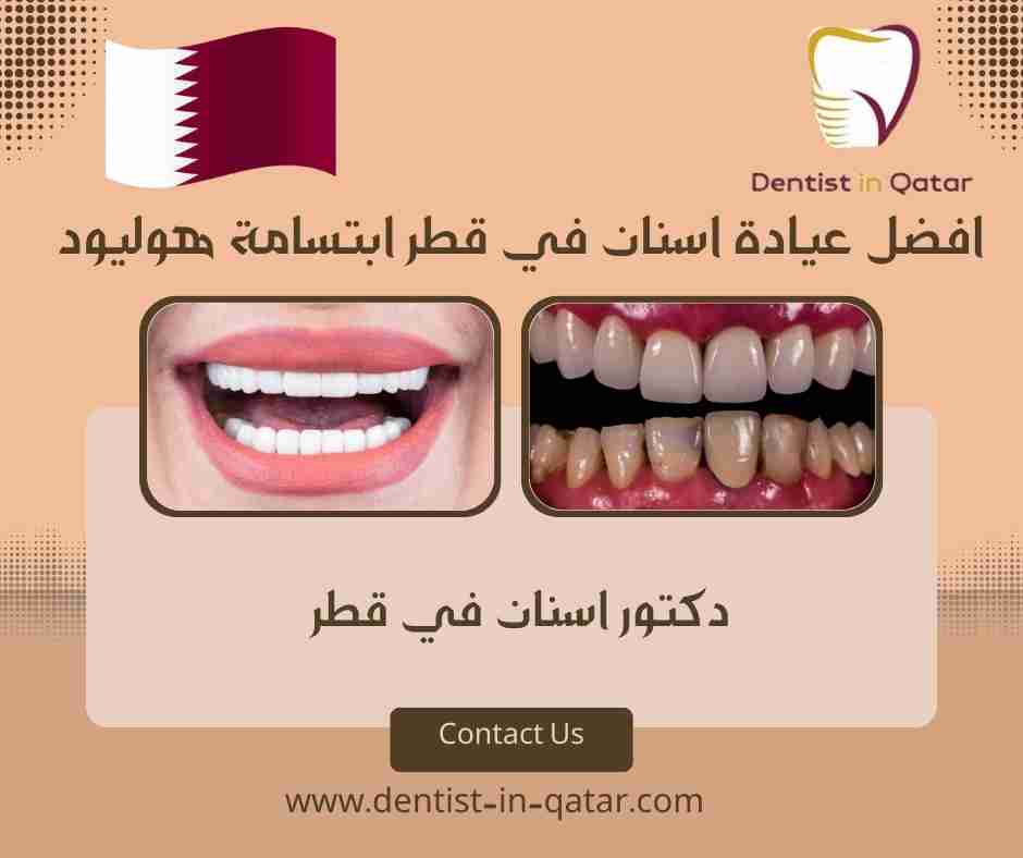 افضل عيادة اسنان في قطر ابتسامة هوليود
