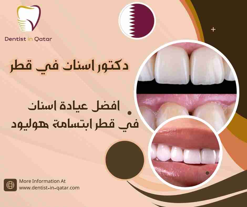 افضل عيادة اسنان في قطر ابتسامة هوليود