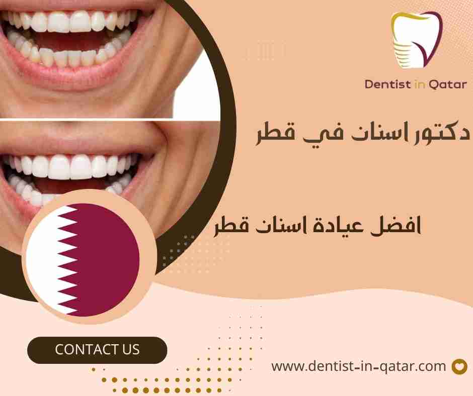 افضل عيادة اسنان قطر