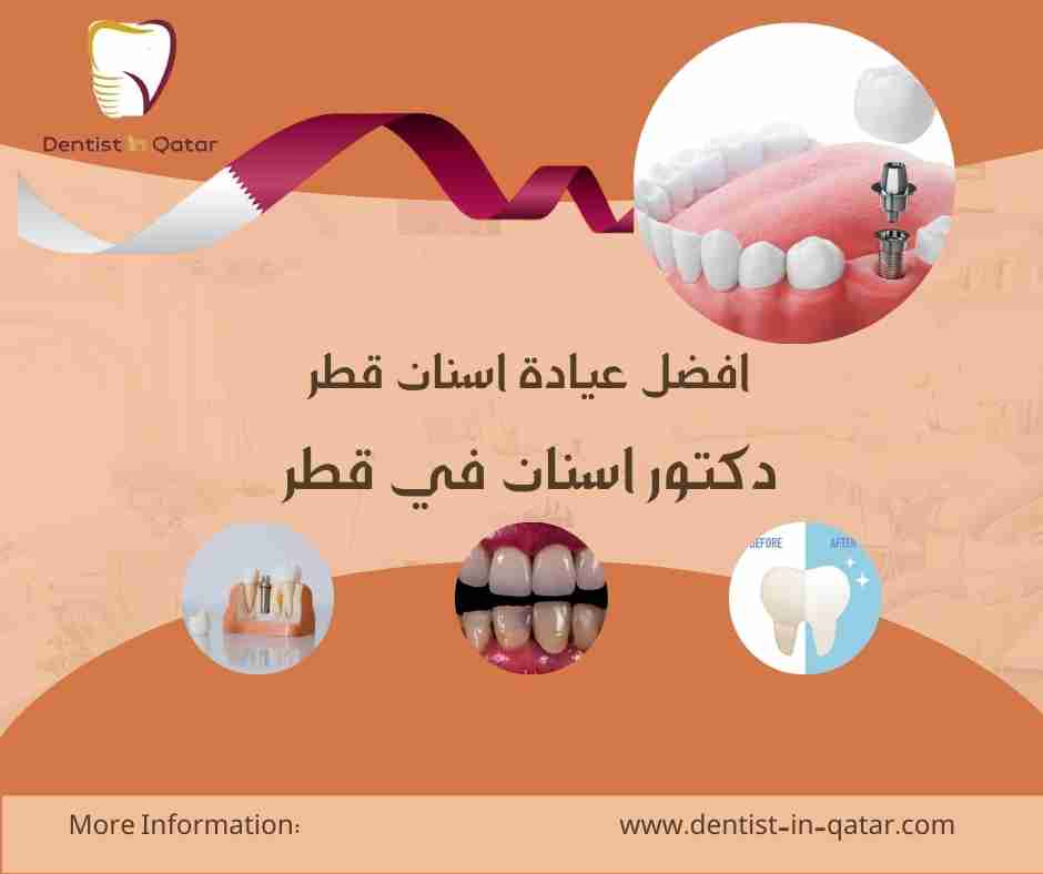 افضل عيادة اسنان قطر
