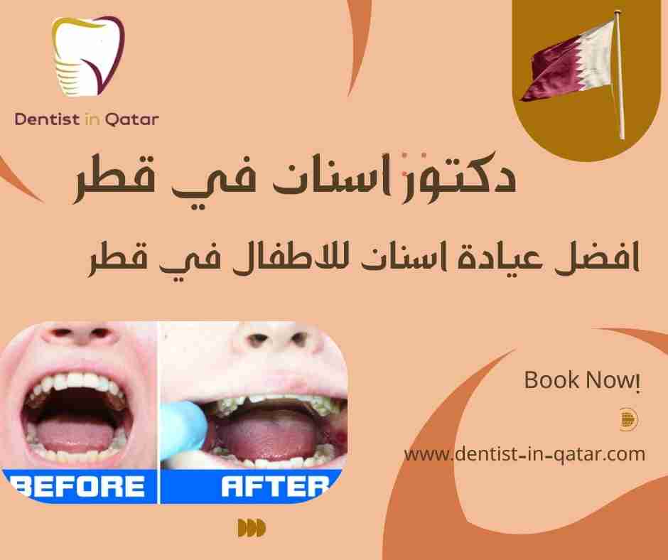 افضل عيادة اسنان للاطفال في قطر