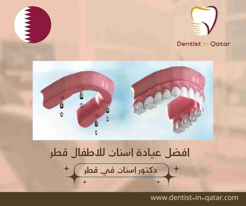 افضل عيادة اسنان للاطفال في قطر