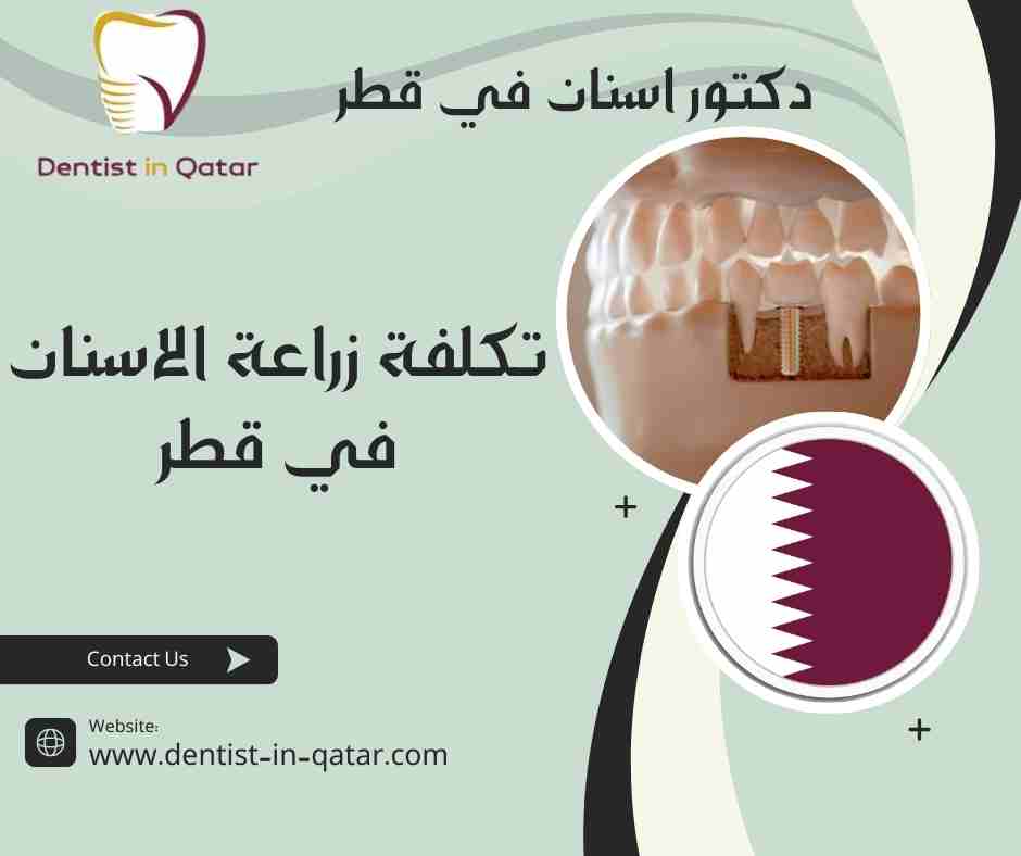 تكلفة زراعة الاسنان في قطر