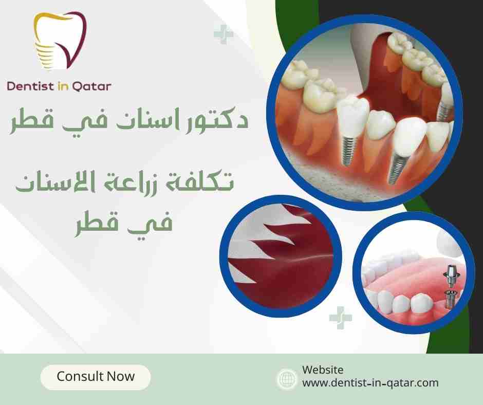 تكلفة زراعة الاسنان في قطر