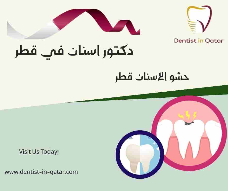 حشو الاسنان قطر