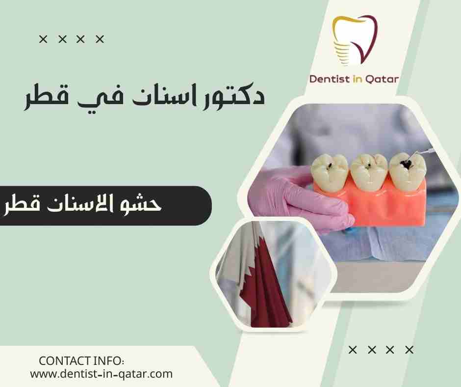 حشو الاسنان قطر