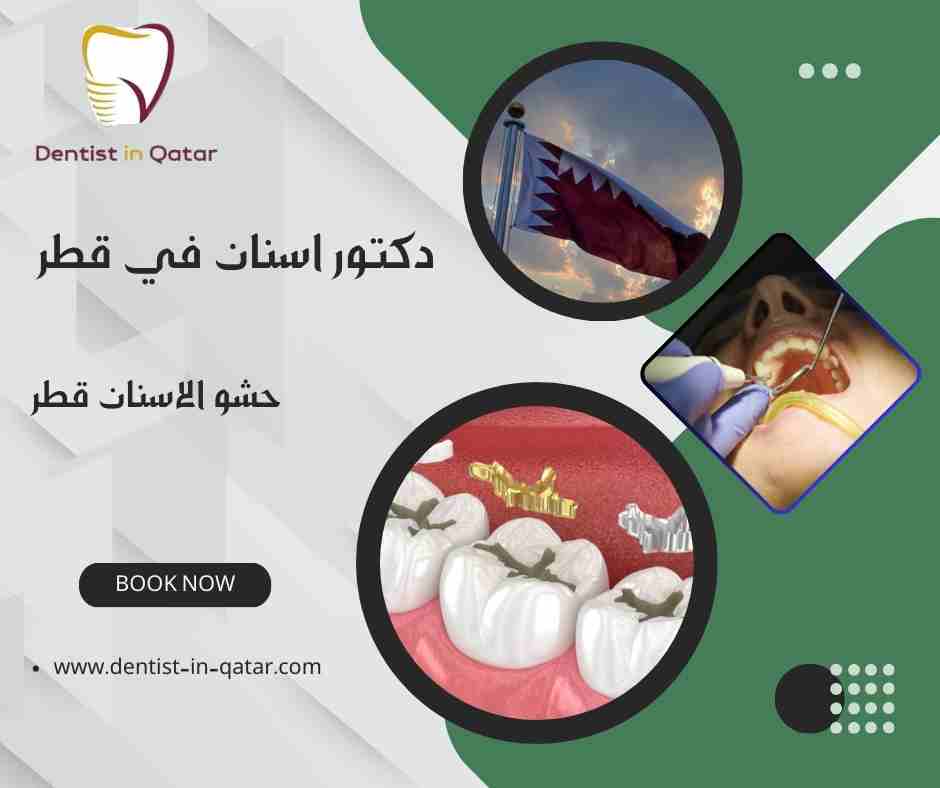 حشو الاسنان قطر