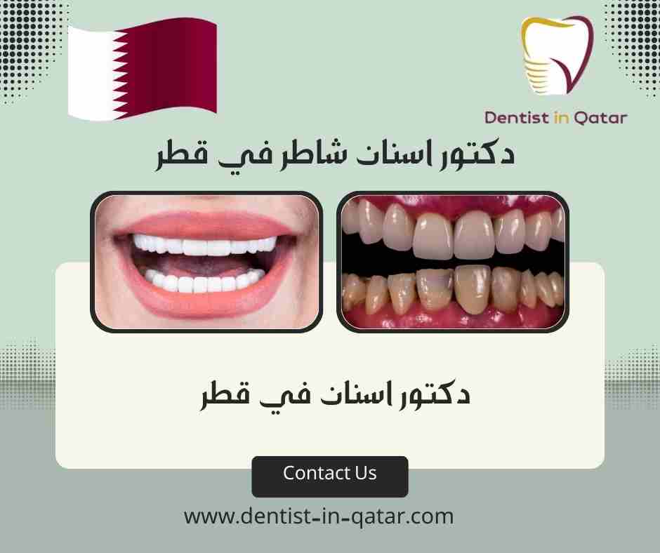 دكتور اسنان شاطر في قطر