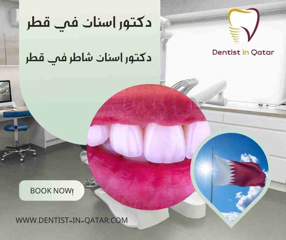 دكتور اسنان شاطر في قطر
