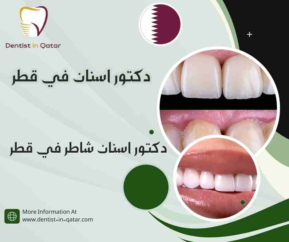 دكتور اسنان شاطر في قطر