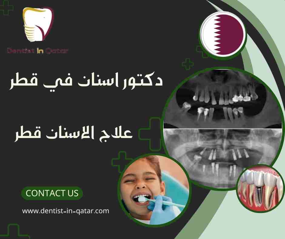 علاج الاسنان قطر