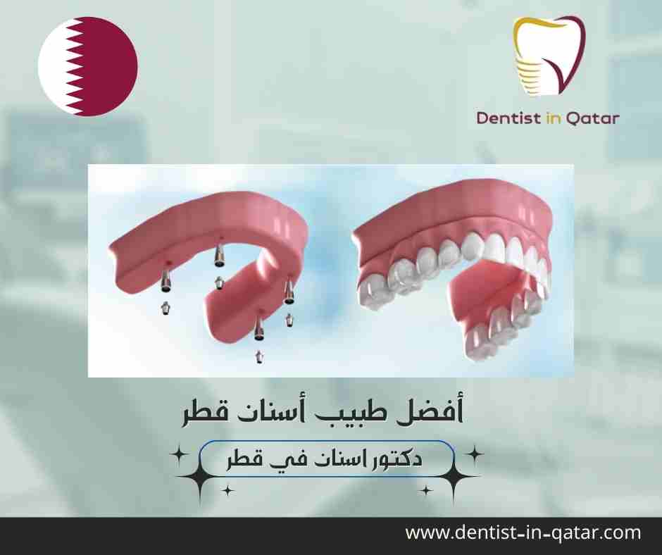 أفضل طبيب أسنان قطر