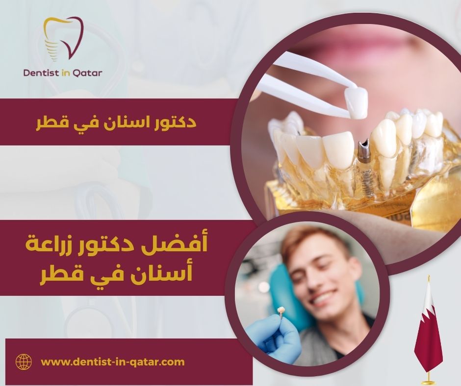 أفضل دكتور زراعة أسنان في قطر