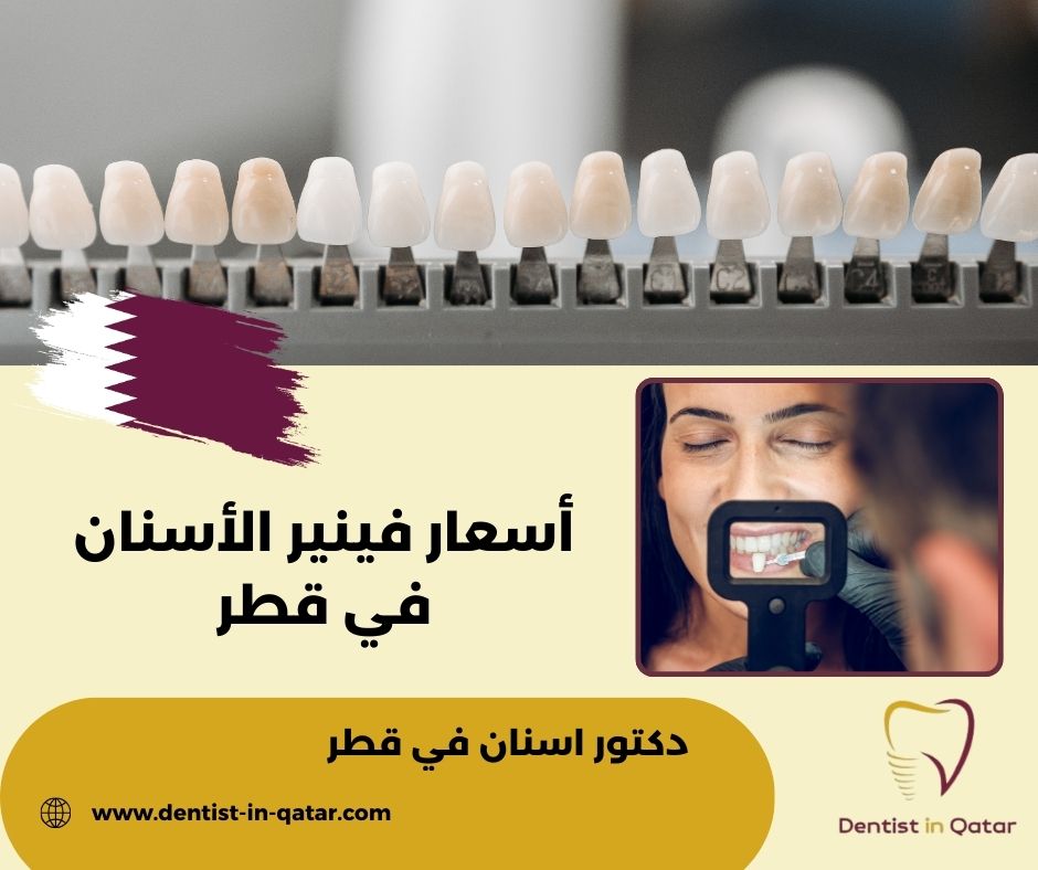 اسعار فينير الاسنان في قطر