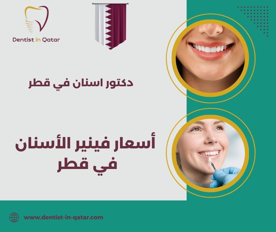 فينير الاسنان قطر