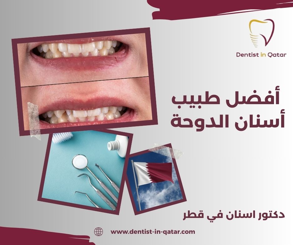 أفضل طبيب أسنان الدوحة