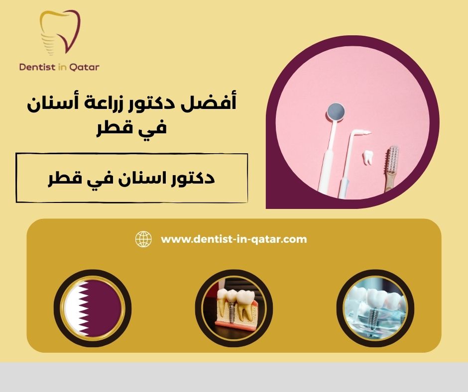 أفضل دكتور زراعة اسنان في قطر