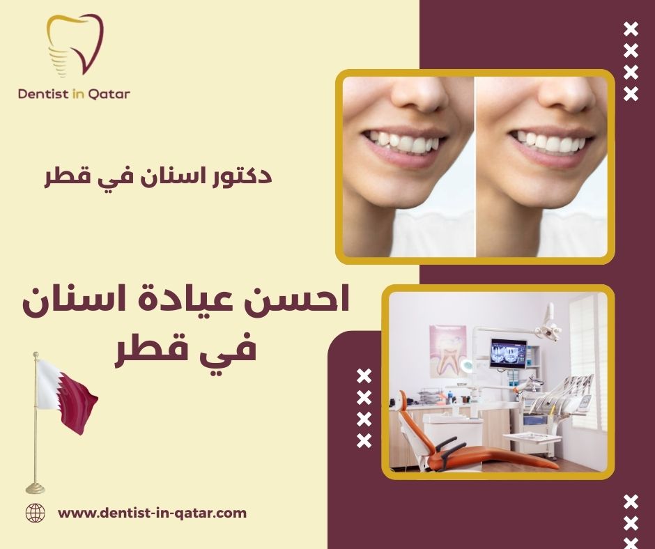 احسن عيادة اسنان في قطر