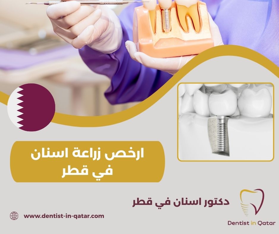ارخص عيادة أسنان في قطر