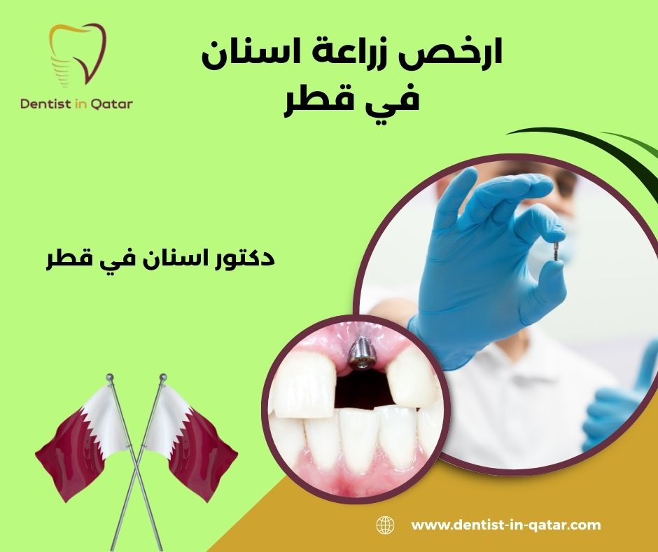 ارخص زراعة عيادة اسنان في قطر