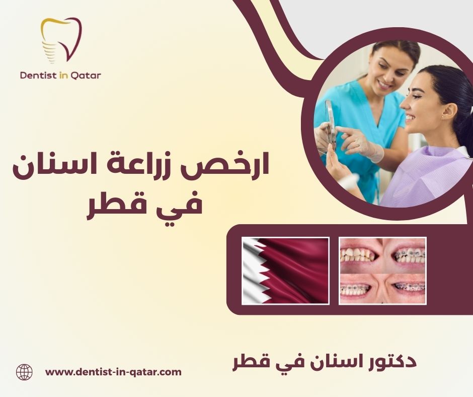 ارخص زراعة اسنان في قطر