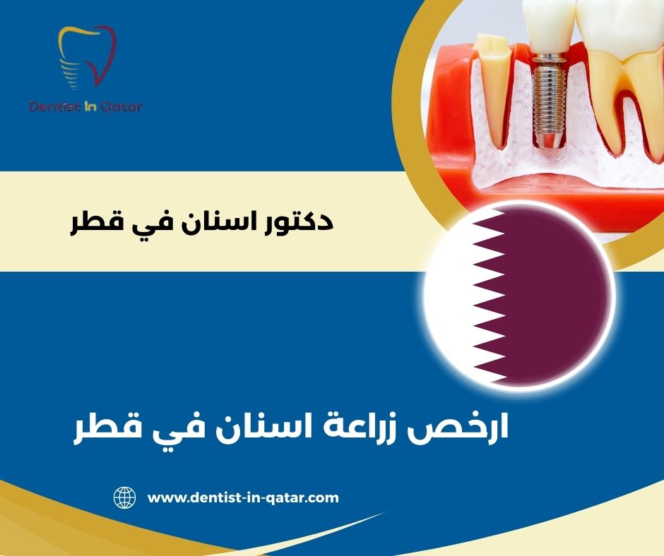 ارخص زراعة اسنان في قطر