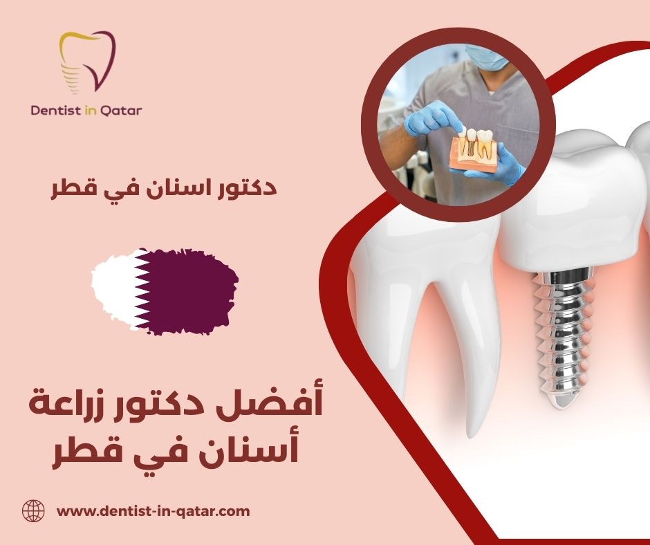 افضل دكتور زراعه اسنان في قطر