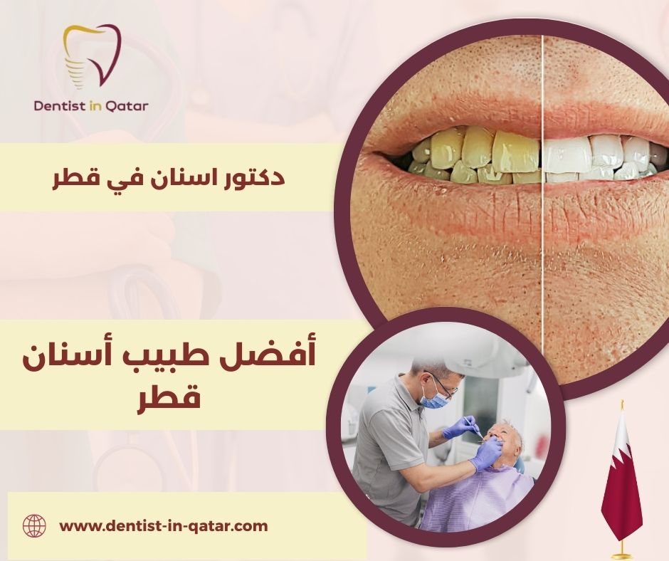 أفضل طبيب أسنان قطر