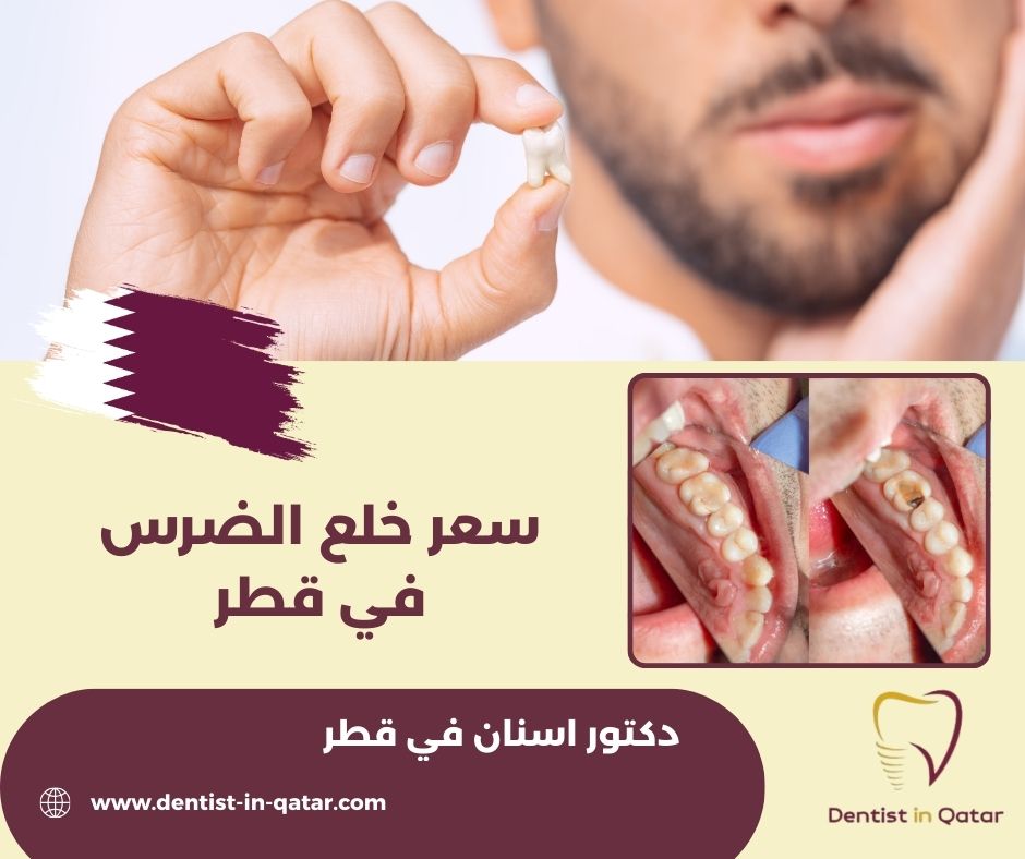 اسعار خلع الضرس في قطر