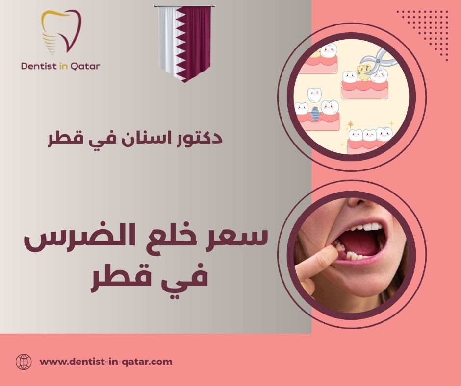 سعر خلع الضرس في قطر