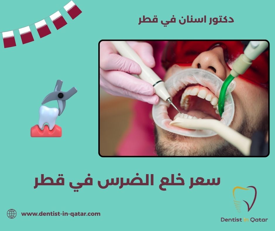 اسعار خلع الاسنان في قطر