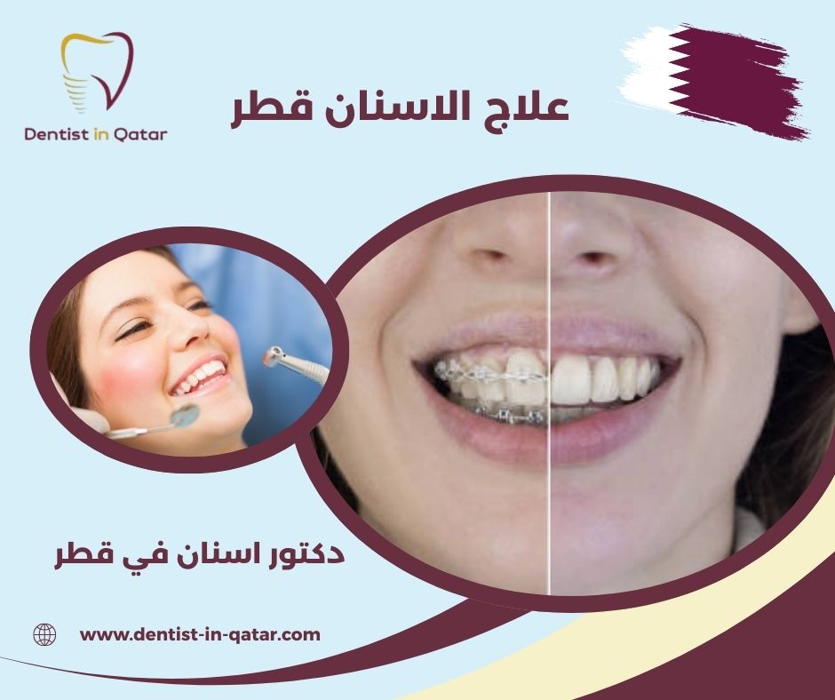 علاج الاسنان قطر