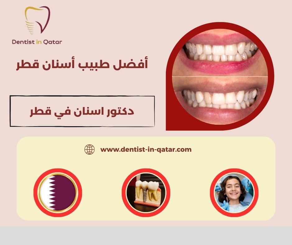 أفضل طبيب أسنان قطر