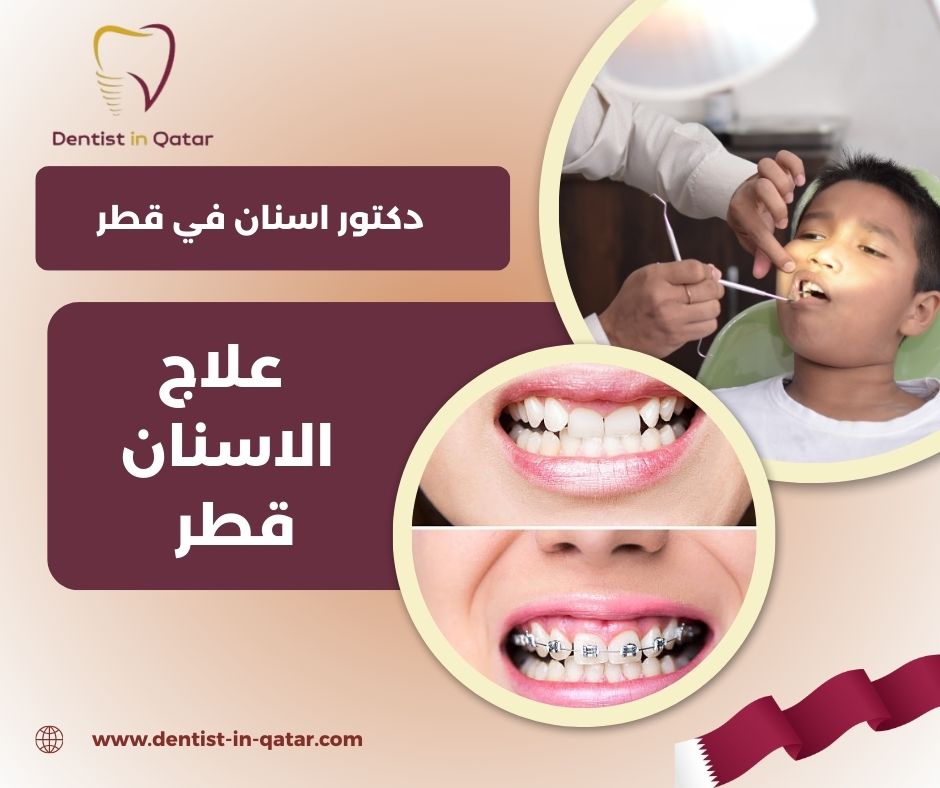 علاج الاسنان في قطر