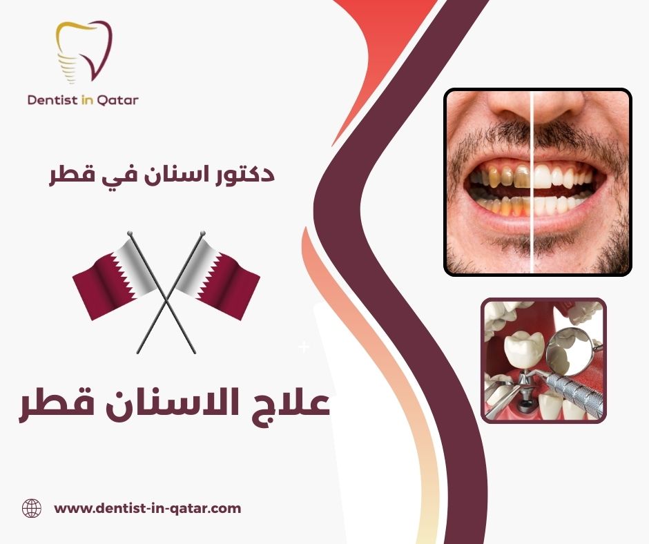 علاج عصب الاسنان قطر