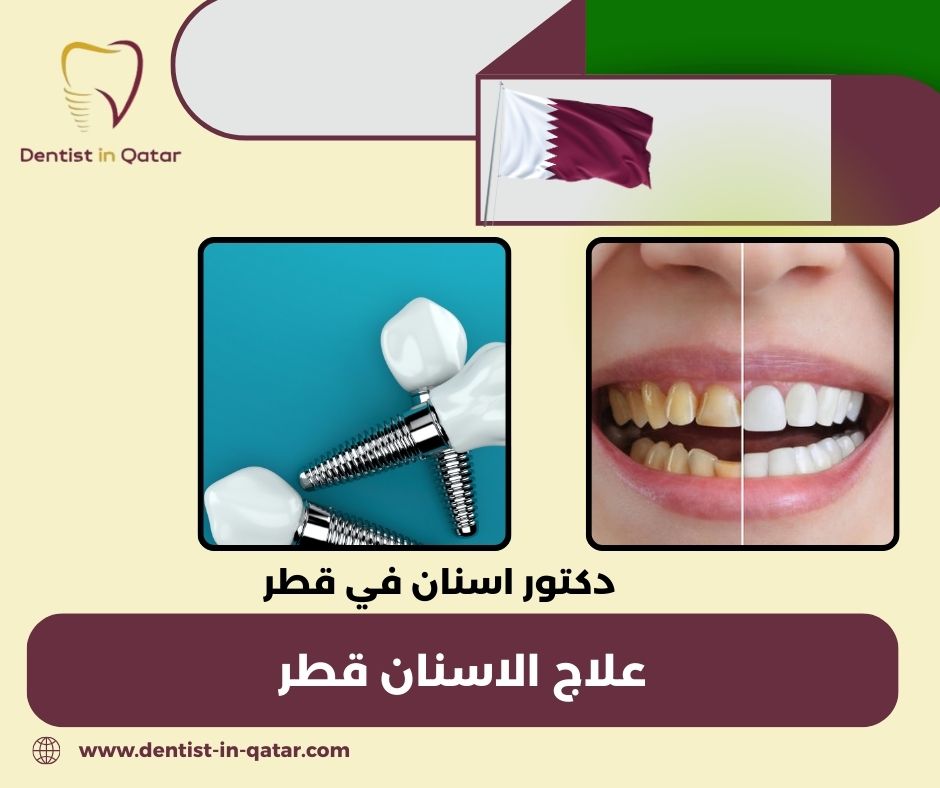 اسعار علاج الاسنان في قطر