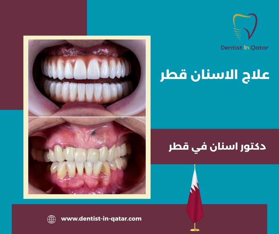 عيادات الأسنان في قطر