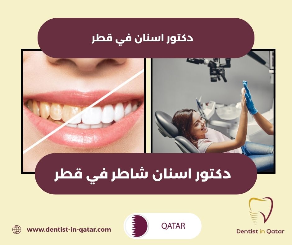 افضل دكتور عصب اسنان في قطر