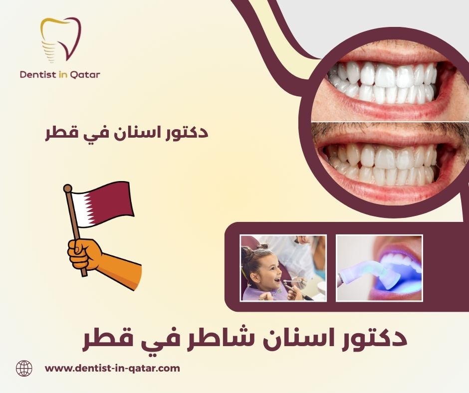 دكتور اسنان شاطر في قطر