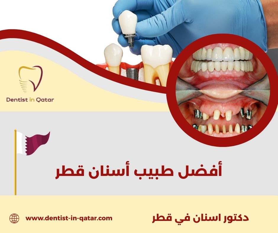 أفضل طبيب أسنان الدوحة