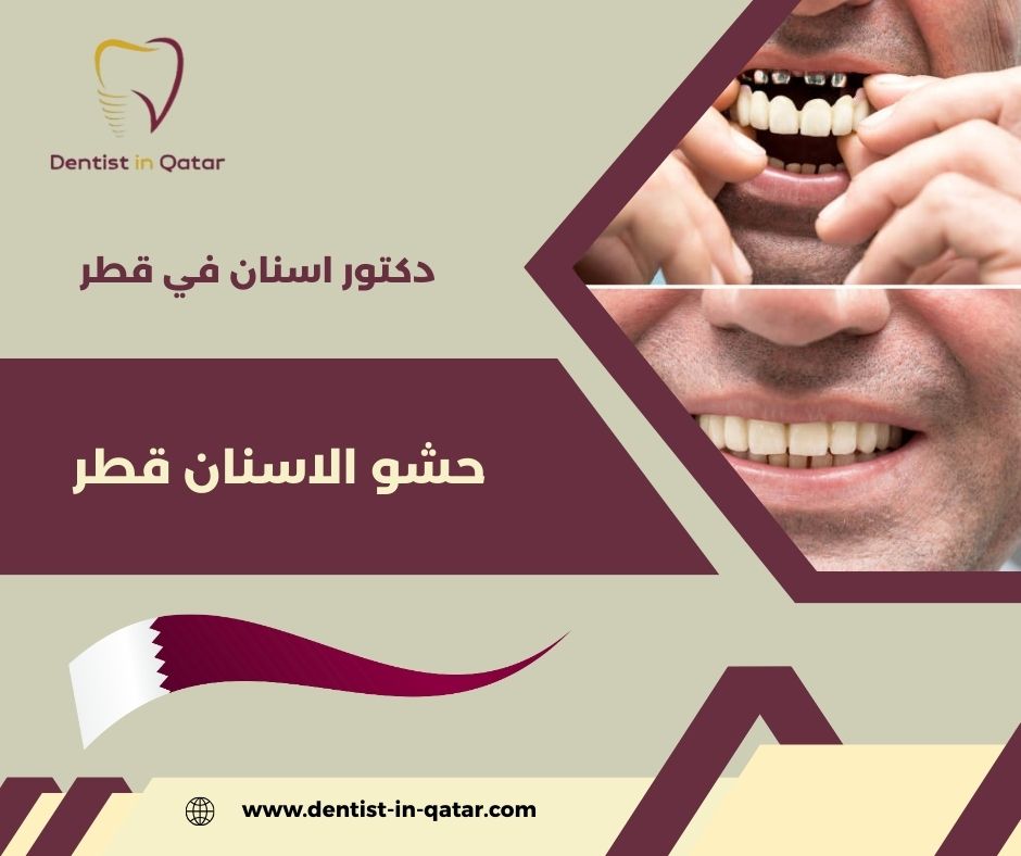 تركيبات الاسنان قطر